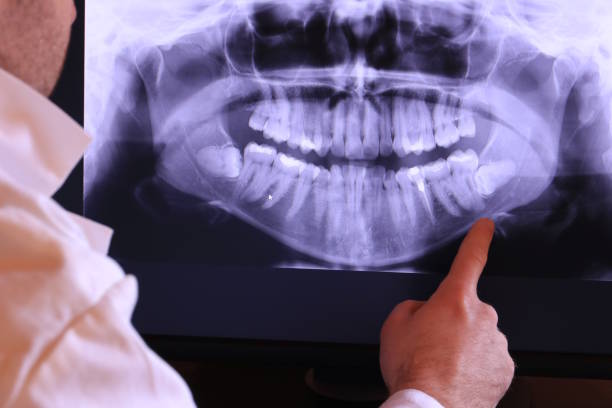 Best Chipped Tooth Repair Near Me  in Oaklyn, NJ